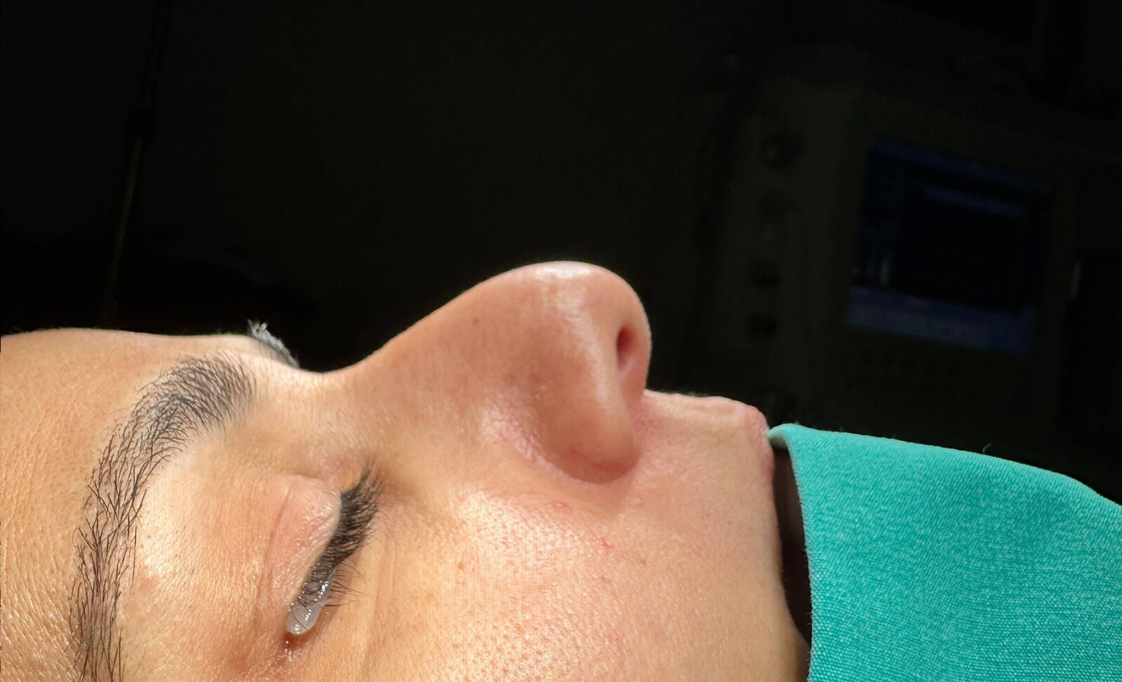 Before