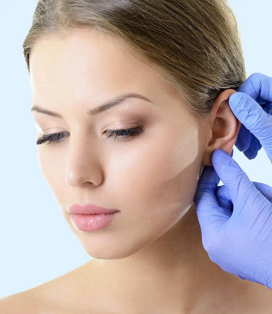 Otoplastie