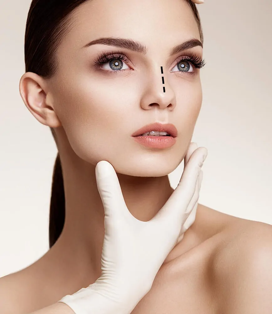 Septorhinoplastie