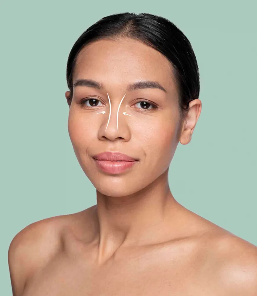 Ethnic Rhinoplasty