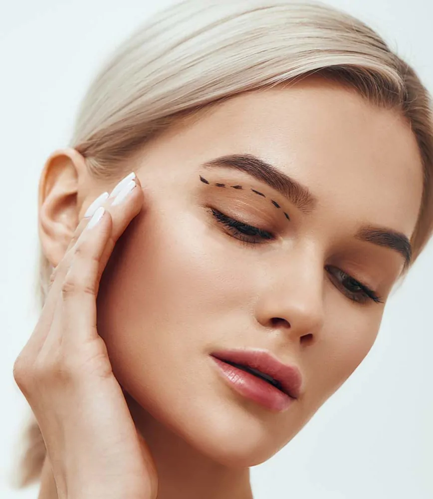Blepharoplasty